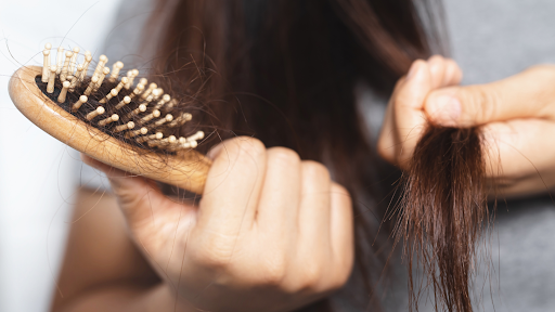 Natural Scalp Treatment for Hair Loss: What You Need to Know Natural Scalp Treatment for Hair Loss: What You Need to Know